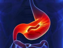 Выявление хеликобактер пилори по дыхательному уреазному тесту