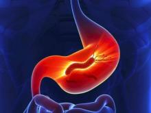 Выявление хеликобактер пилори по дыхательному уреазному тесту